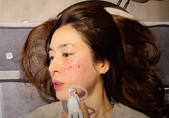 피흘리며 시술받는 민혜연→남편 몰래 성형한 유하나…★아내다운 당당 고백[TEN피플]