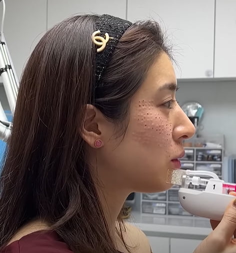 피흘리며 시술받는 민혜연→남편 몰래 성형한 유하나…★아내다운 당당 고백[TEN피플]