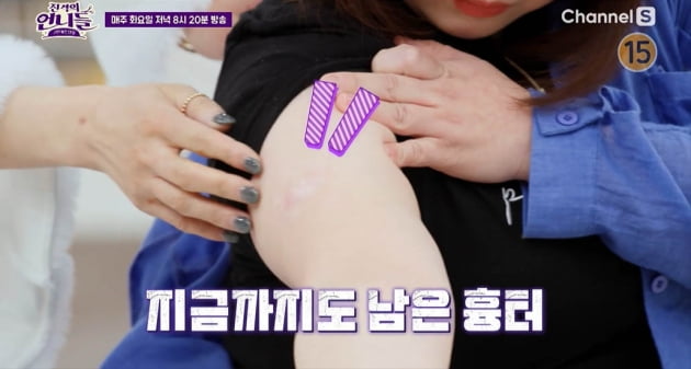 [종합] "고데기로 지지고 감금"…'더글로리' 현실판 피해자 등장, 가해자는 간호사·복지사('진격')
