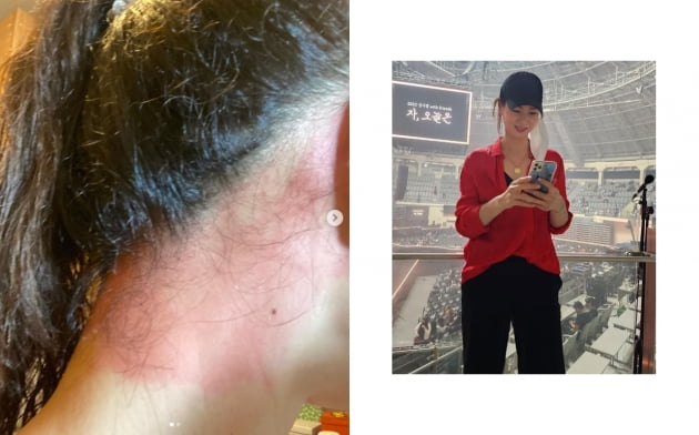 이소라, 좋다고 하는 샴푸 썼는데...충격적인 피부 상태