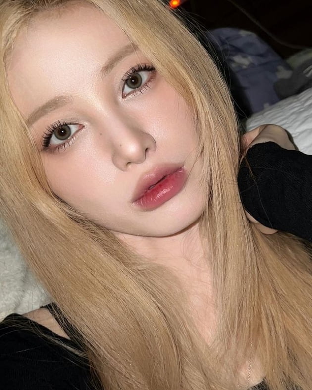 '돌싱' 유깻잎, 게장 먹고 피부 트러블? "평생 못 먹나봐 나" 울상