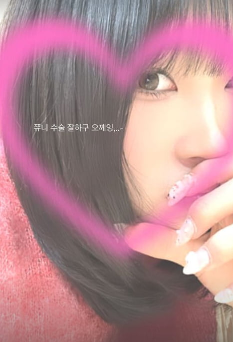 ‘최진실 딸’ 최준희, 코 재수술 하러갔나