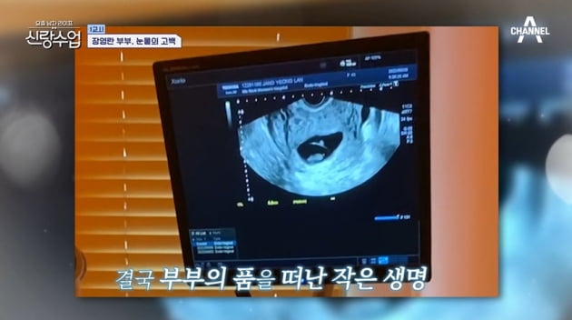 [종합] 장영란 "셋째 유산 후 냉철했던 ♥한창에 서운" 눈물 폭발