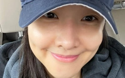 '42세 애둘맘' 김빈우, "노화 대비" 눈밑지방재배치로 비주얼 업그레이드