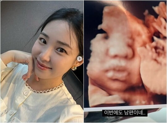 (사진=최희 SNS)