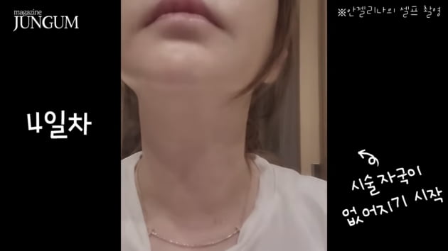 [종합] 박준금, 62세에도 MZ만큼 탱탱한 피부…‘헉’소리 나는 시술 고백