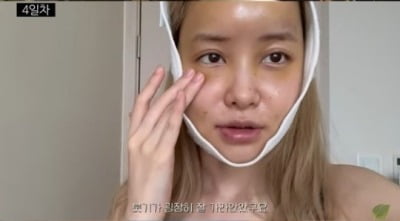 [종합] 유깻잎, 지방이식·윤곽 수술…"6시간 수술, 남친이 도라에몽이라고"