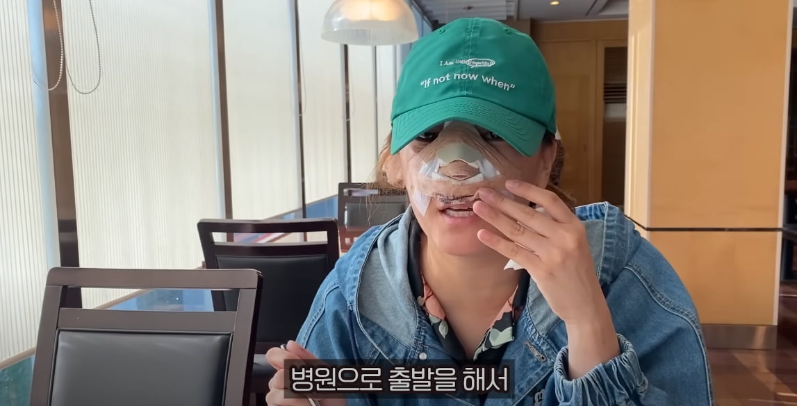 '코 재수술' 고은아, 2차 수술 또 해야할 수도…"실리콘 無, 상황 지켜봐야"('방가네')