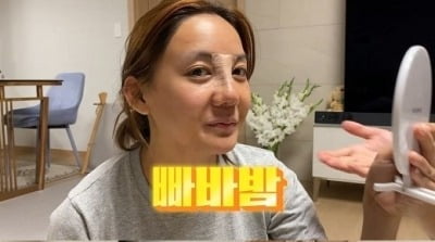 [종합] 고은아, 코 재성형한다…"조직 죽어있고 엉켜있는 상태"('방가네')