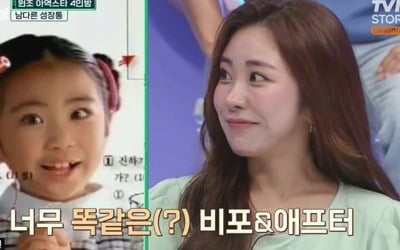 "성형 많이했는데 똑같아" 김성은, 수술 전후 공개 '깜짝'…"내 시간·돈·고통" 호소 ('살아있네') [TEN이슈]