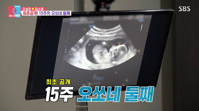 사진=SBS '동상이몽2' 방송 캡처본.