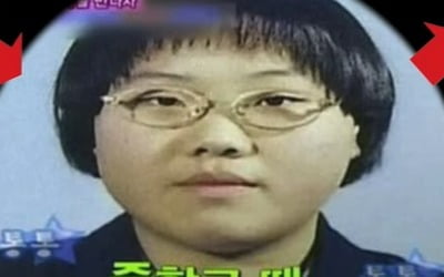 신봉선, 성형 전 변천사 공개…"살 디룩디룩, 너무 못생겼다"