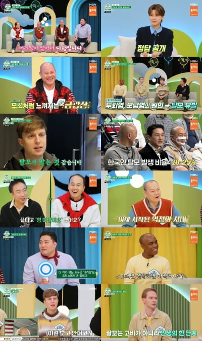 “If it wasn't for my hair loss, I would have appeared in a romance drama” Regrets the villain actor