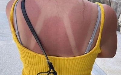 Lee So-yeon's shocking current status, including her red ripe face