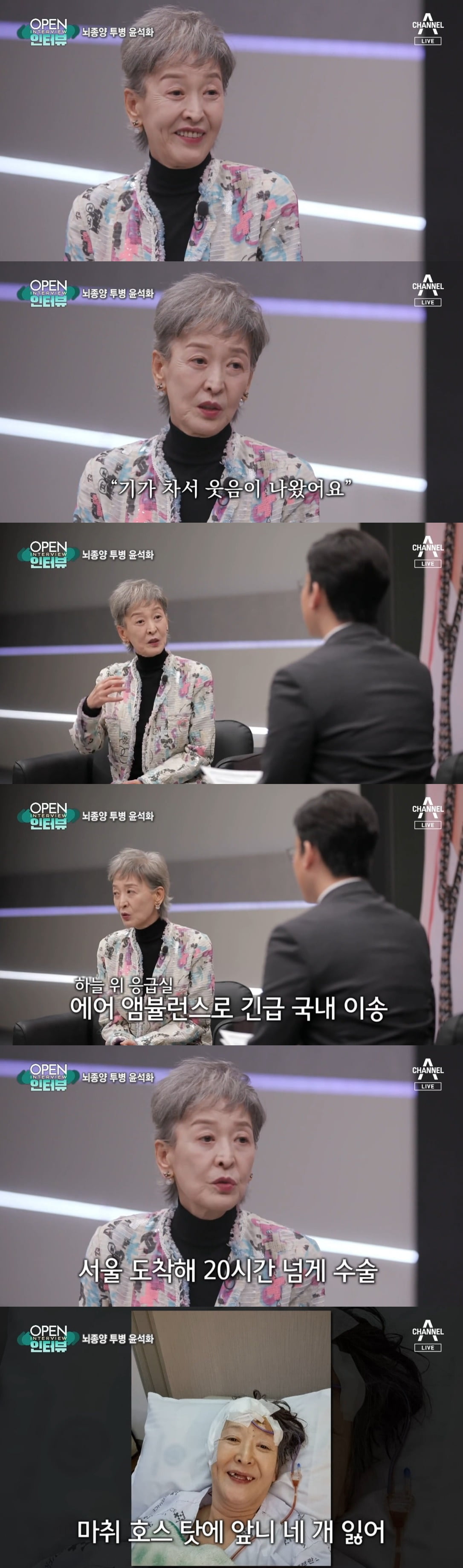 윤석화 /사진=채널A '뉴스A' 방송 화면 캡처