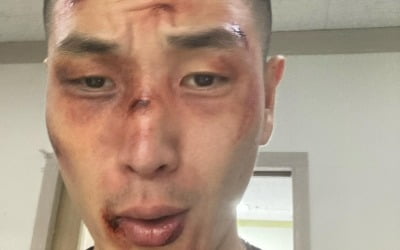 'BTS diss' BFree criticizes police for blocking 'disabled people's protest'