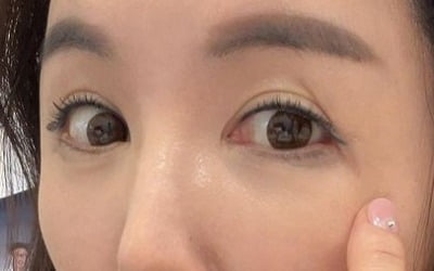 Jang Young-ran, a working mother who drew eyeliner even when having a cesarean section