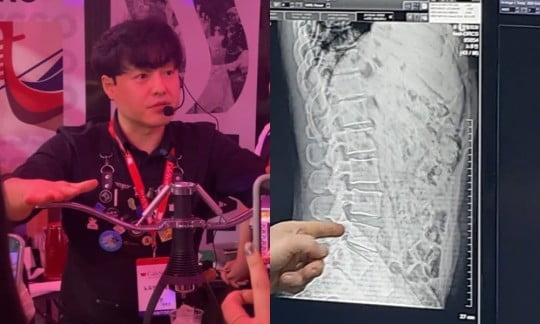 노유민, 호흡 곤란→아내는 SNS 삼매경…논란 일축에도 비판 쏟아진 이유 [TEN피플]