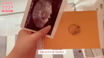 ‘Park Soo-hong♥’ Kim Da-ye, successful embryo transfer… The ultrasound picture “brings tears to my eyes”