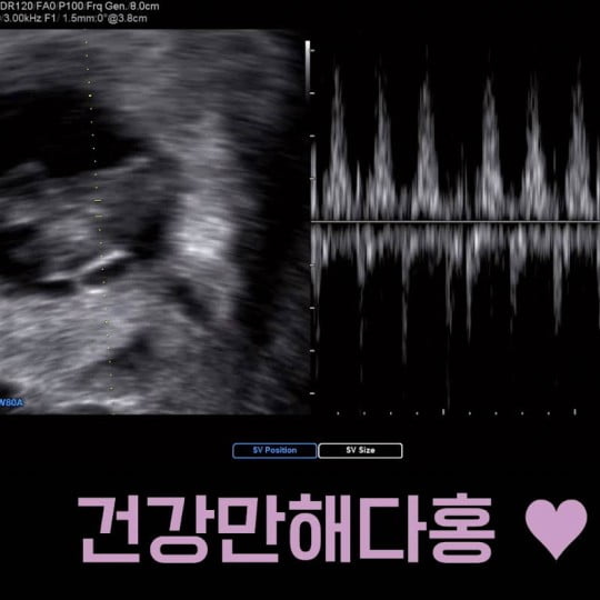 / 사진=김다예 SNS