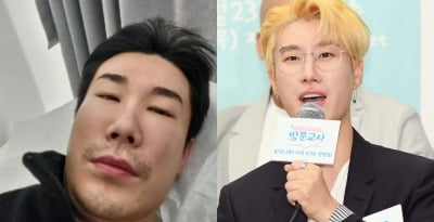 "진짜 갈 수가 없었어" 산이, 퉁퉁 부은 얼굴 '깜짝'…제작발표회 참석 못 한 이유 [TEN이슈]