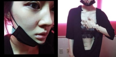 T-ara Areum reveals photos of evidence of assault by her former husband