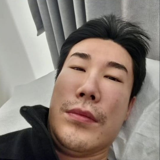 '부비동염→얼굴 부은' 산이, 금전요구 연락 박제 [TEN★]