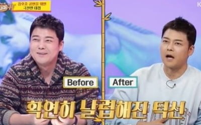 Jeon Hyun-moo confesses to losing 4 kg