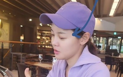 'Single Single' Ahn Hyun-mo reveals his swollen eyes