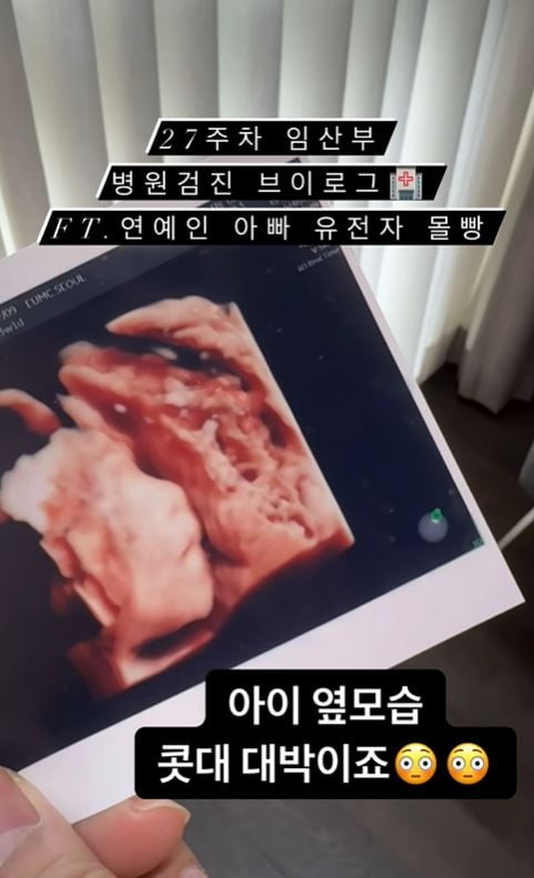 사진 = 아야네 SNS 갈무리