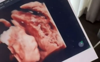 '이지훈♥' 아야네, 2세 콧대에 감탄…"좋겠다 아빠가 이지훈이라" [TEN★]