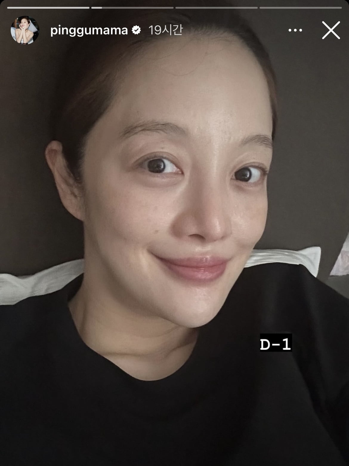 배우 황보라/사진=황보라 SNS 캡처