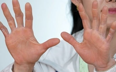 "손가락 지문 없어"…다 닳아버린 손, 김자인 충격 상태 공개 ('사당귀')