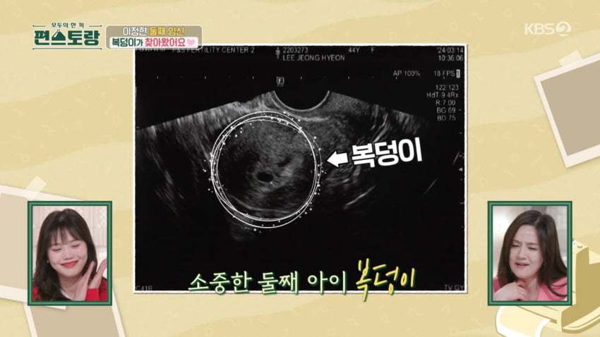 사진=KBS2 '신상출시 편스토랑'