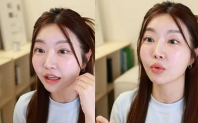 레이디제인, 눈 성형했다…"10분 만에 수술, 티 너무 많이 나" [TEN이슈]