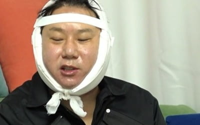 Lee Sang-min had chin surgery