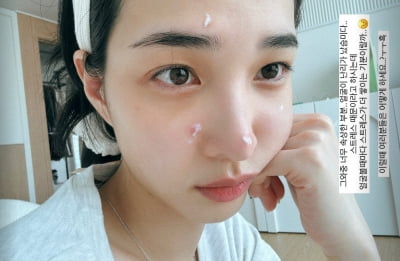 '돌싱' 율희, "속상해, 스트레스" 토로…어쩌다 얼굴이 이 모양