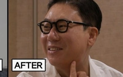 Lee Sang-min, the chin plastic surgery effect is amazing.