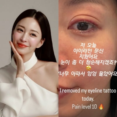 한예슬, 퉁퉁 부은 눈 보이며..."엉엉 울었어, 고통레벨 10"