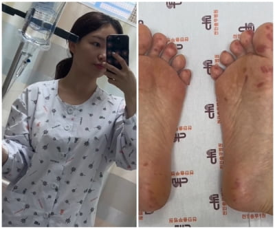'돌싱글즈' 이아영, 심각한 건강 상태로 결국 입원