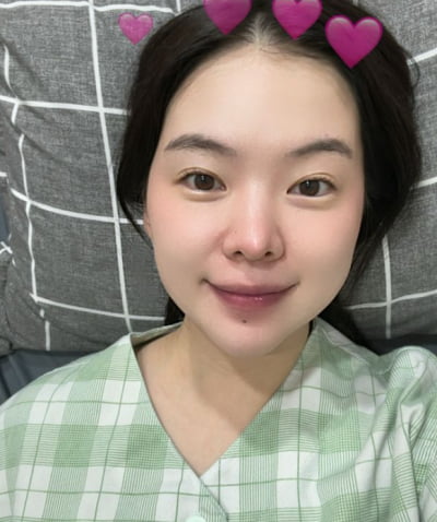 하늘, 子 출산 70일만에 코 수술…"10년전 실리콘 빼면서 피부 뒤틀려"