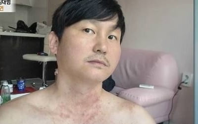 [종합] '마빡이' 김대범, 전 재산 잃고 잠적했다…"온몸 덮은 피부염에 잠도 못자" ('특종세상')