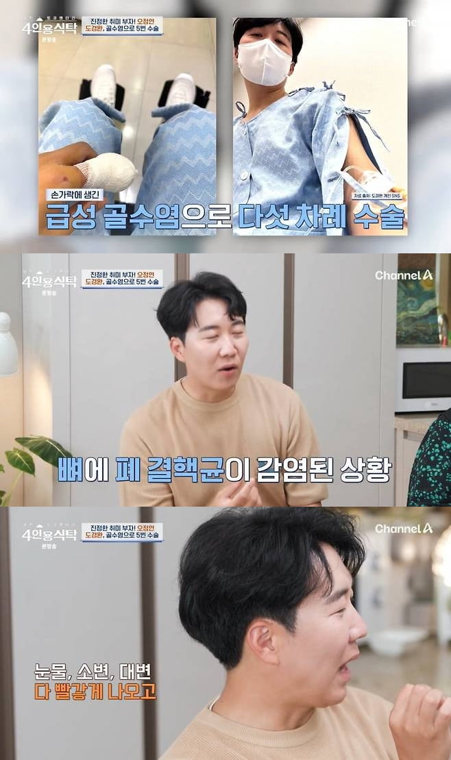 [종합] '장윤정♥' 도경완, 급성 골수염 투병 고백…"항생제 부작용에 피눈물 흘려" ('4인용식탁')