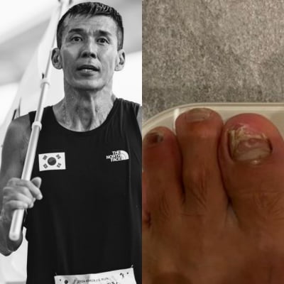 멀쩡한 발톱이 없네…션 "광복절 81.5km 러닝 후 4kg 빠져"