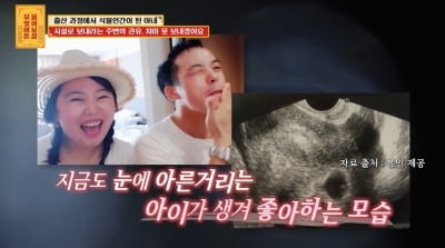 [종합] "출산 중 식물인간→7세 정신연령으로 깨어나"…30대 아내, 결국 중증 치매 진단 ('물어보살')