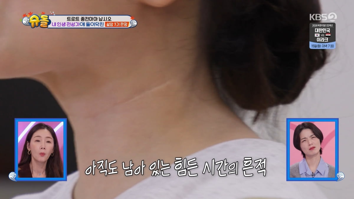 사진=KBS2 '슈퍼맨이 돌아왔다'