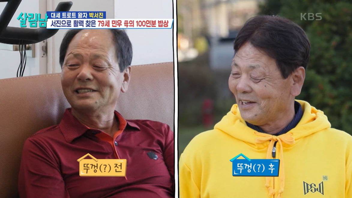 '성형 1억' 박서진, 모발이식까지 받았다…"탈모약 복용 중"('살림남') [종합]