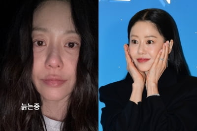 '54세' 고현정, 수술 전후 확 달라진 안색…"늙는 중"