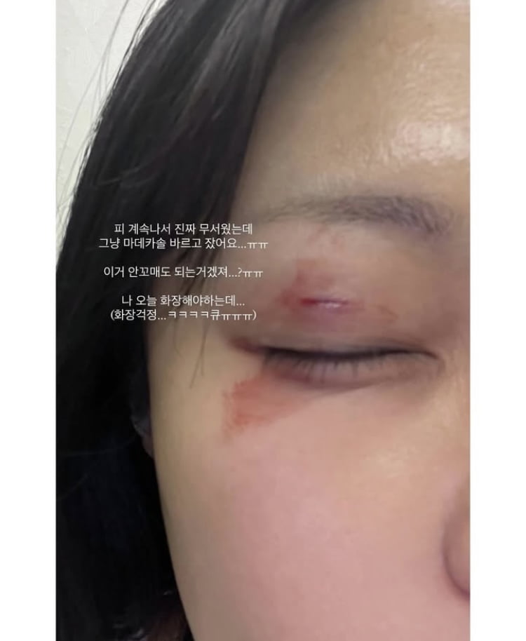 유상무 대장암 완치 3년만에… ♥김연지, 때아닌 응급실행