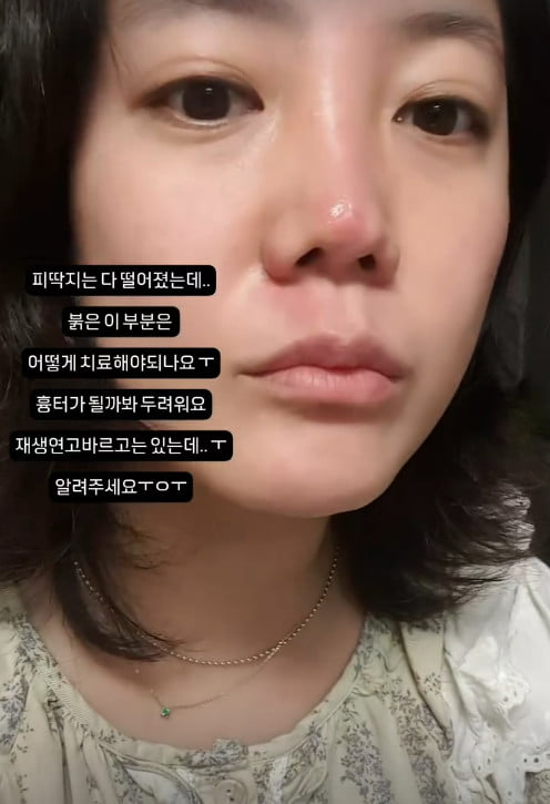 사진=고은아 SNS